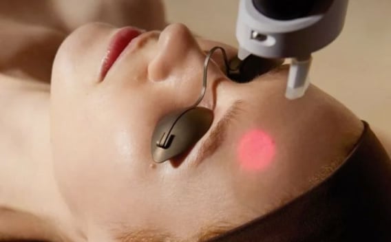 IPL Photorejuvenation Laser